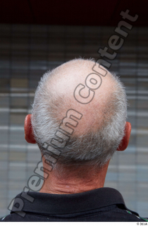 Street  661 bald hair head 0001.jpg